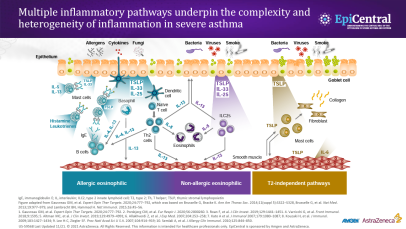 The inflammatory cascade - Thumbnail image