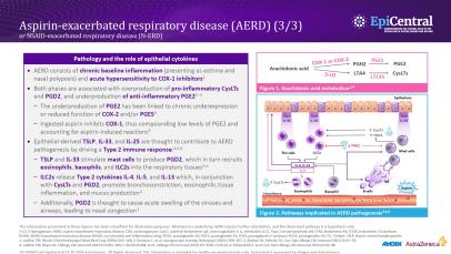 Image from Additional Phenotypes of Chronic Rhinosinusitis: AERD and AFRS