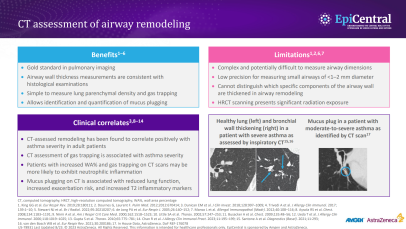 Imaging of airway remodelling