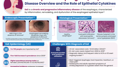 EoE infographic thumbnail