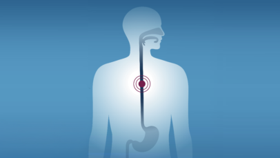 Upper GI Tract