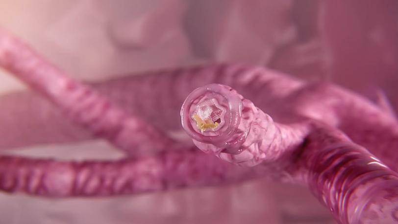 EpiFundamentals Topic Lower Airway teaser image