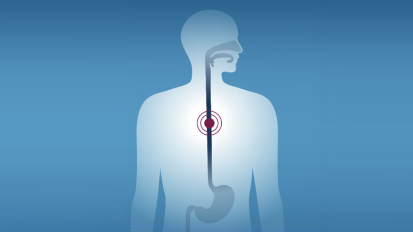 Upper GI Tract