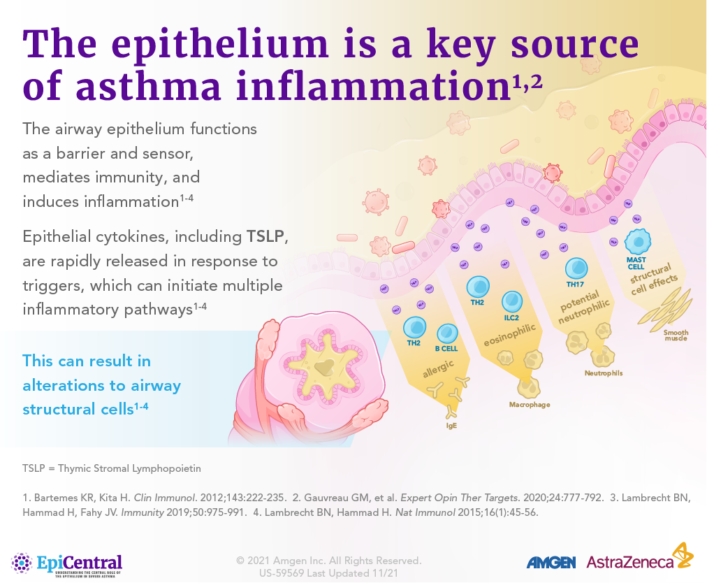 The epithelium is a key source of inflammation infographic