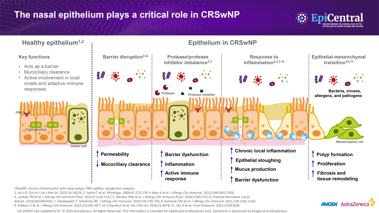 The nasal epithelium plays a critical role in CRSwNP