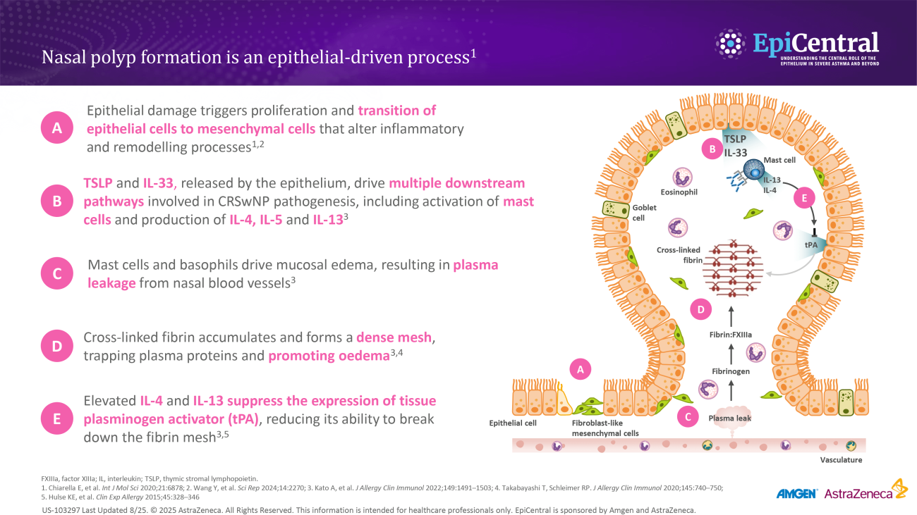 Nasal polyp formation is an epithelial-driven process