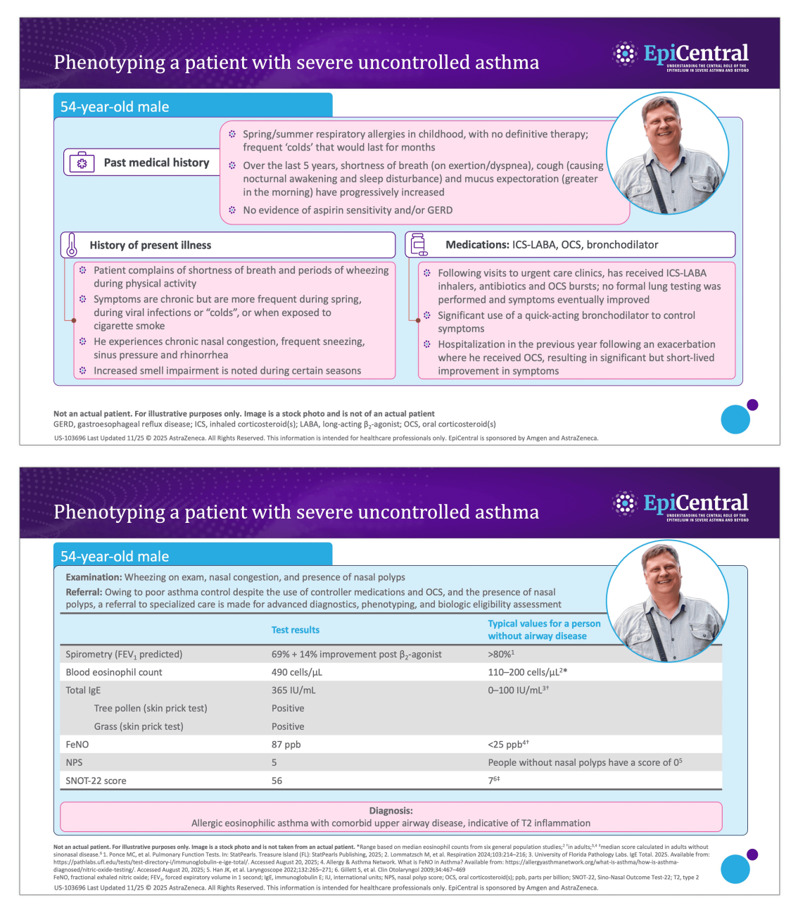 Case study