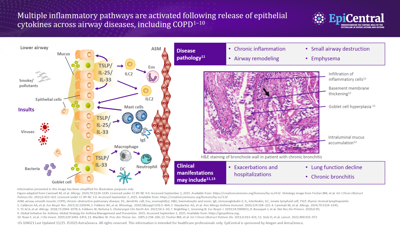 US EpiCentral_COPD Module_Multiple Inflammatory Pathways in COPD_Hero Asset