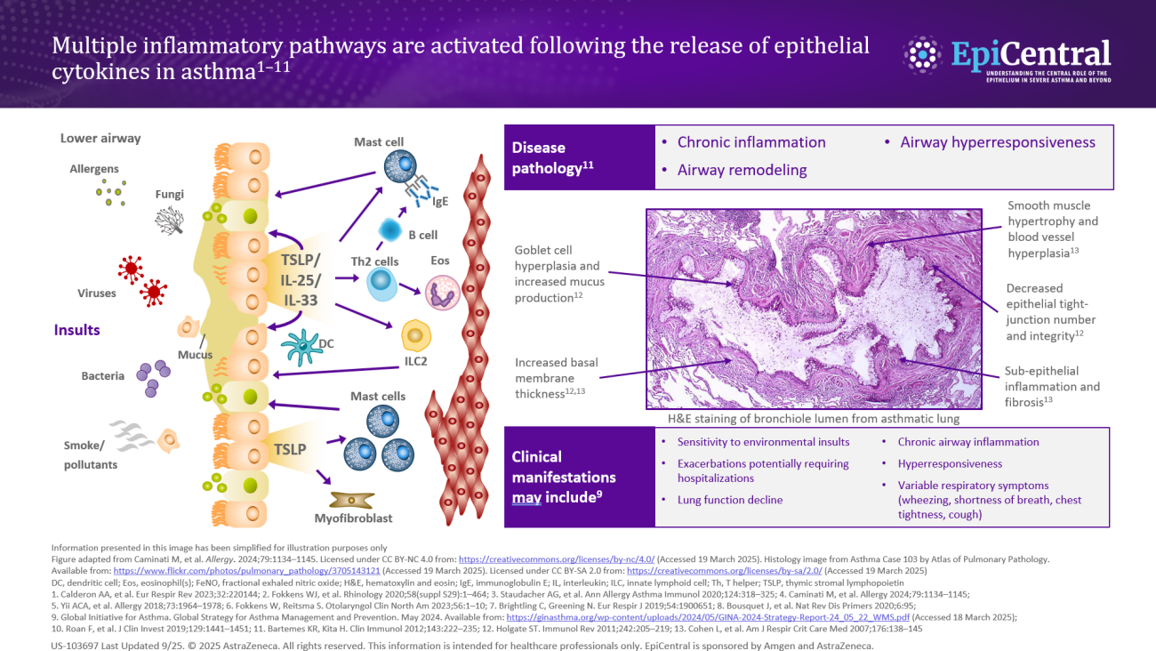 US EpiCentral_Module 4_Image_inflammatory pathways in asthma_hero asset