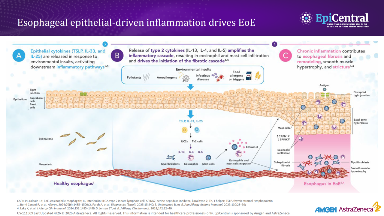 Esophageal inflammation